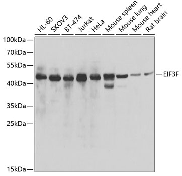 Western blot - EIF3F Polyclonal Antibody 