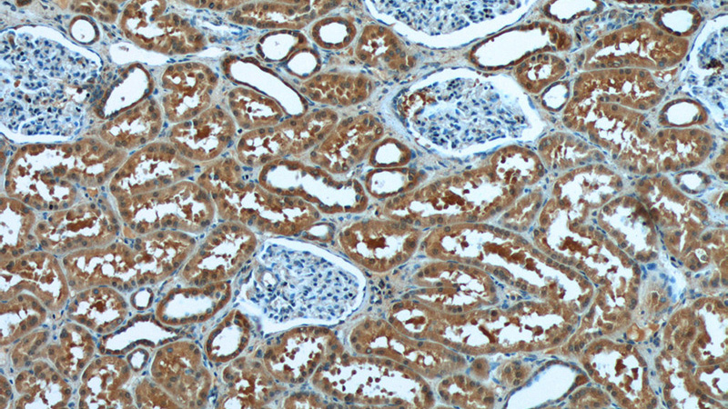 Immunohistochemistry of paraffin-embedded human kidney tissue slide using Catalog No:109680(CYP11B2 Antibody) at dilution of 1:50 (under 10x lens)