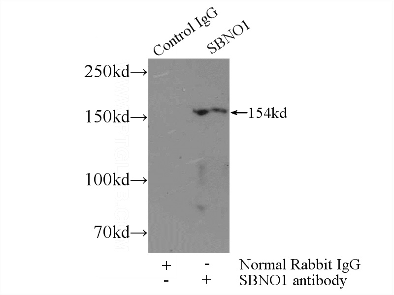 IP Result of anti-SBNO1 (IP:Catalog No:114980, 3ug; Detection:Catalog No:114980 1:300) with HeLa cells lysate 1800ug.