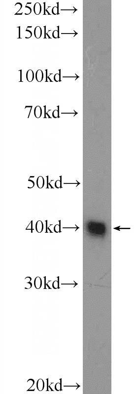 HeLa cells were subjected to SDS PAGE followed by western blot with Catalog No:112860(MRPS5 Antibody) at dilution of 1:600