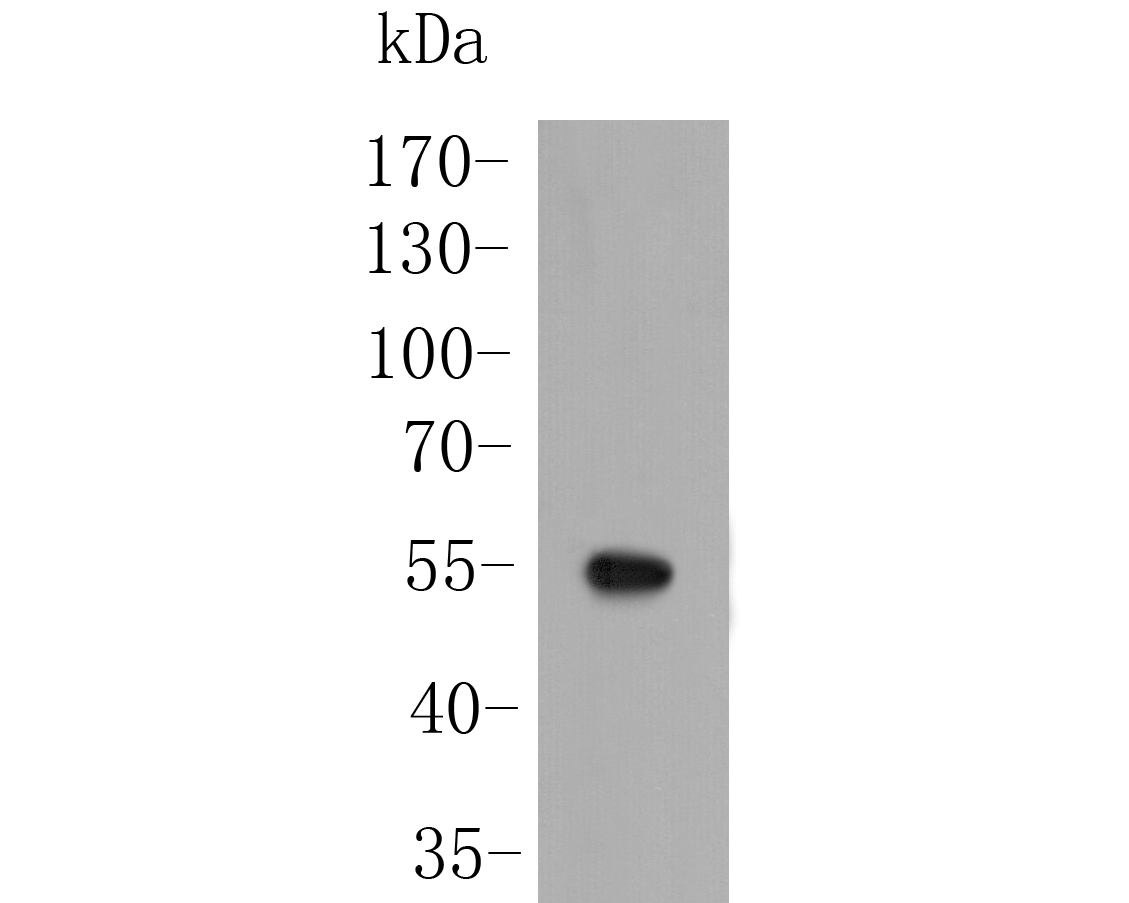 Fig1:; Western blot analysis of SARS2 on Zebrafish tissue lysate. Proteins were transferred to a PVDF membrane and blocked with 5% BSA in PBS for 1 hour at room temperature. The primary antibody ( 1/500) was used in 5% BSA at room temperature for 2 hours. Goat Anti-Rabbit IgG - HRP Secondary Antibody (HA1001) at 1:5,000 dilution was used for 1 hour at room temperature.