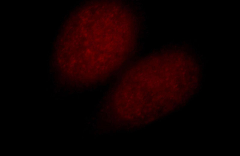 Immunofluorescent analysis of Hela cells, using N-PAC antibody Catalog No:111092 at 1:25 dilution and Rhodamine-labeled goat anti-rabbit IgG (red).