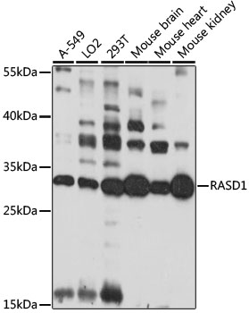 Western blot - RASD1 Polyclonal Antibody 