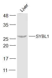 Fig1: Sample:; Liver (Mouse) Lysate at 40 ug; Primary: Anti-SYBL1 at 1/300 dilution; Secondary: IRDye800CW Goat Anti-Rabbit IgG at 1/20000 dilution; Predicted band size: 25 kD; Observed band size: 26 kD