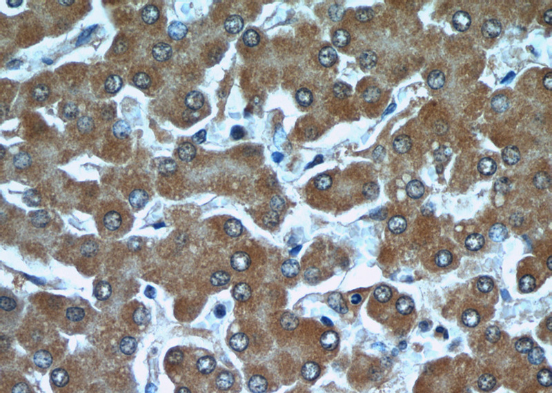 Immunohistochemical of paraffin-embedded human liver using Catalog No:107650(TTL antibody) at dilution of 1:50 (under 40x lens)