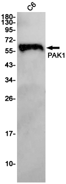 Western blot detection of PAK1 in C6 cell lysates using PAK1 Rabbit pAb(1:1000 diluted).Predicted band size:61KDa.Observed band size:61KDa.