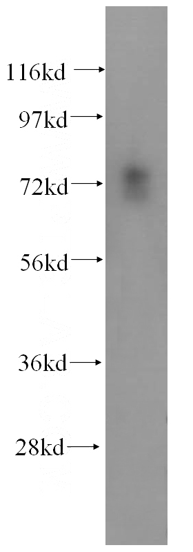 mouse cerebellum tissue were subjected to SDS PAGE followed by western blot with Catalog No:114999(SCLT1 antibody) at dilution of 1:300