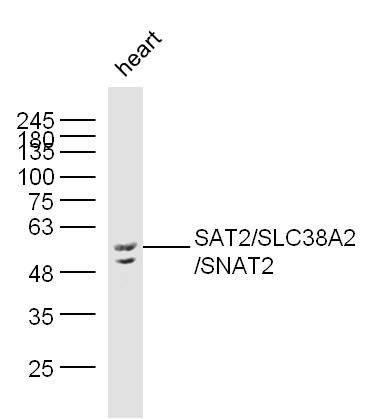 Fig1: Sample:; Heart (Mouse) Lysate at 40 ug; Primary: Anti-SLC38A2 at 1/300 dilution; Secondary: IRDye800CW Goat Anti-Rabbit IgG at 1/20000 dilution; Predicted band size: 56 kD; Observed band size: 56 kD
