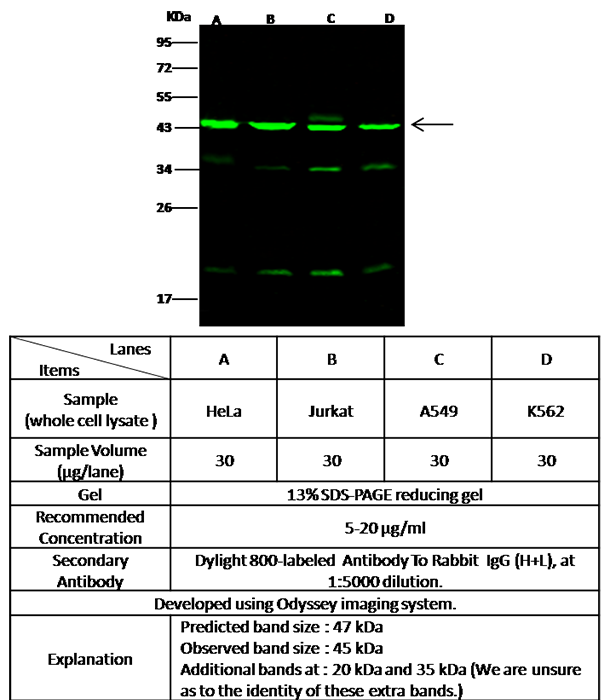 Human ACTR3/Actin-related protein 3 Western blot (WB) 15648