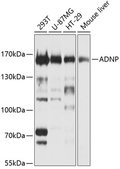 Western blot - ADNP Polyclonal Antibody 