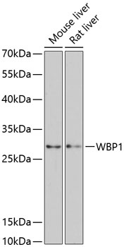 Western blot - WBP1 Polyclonal Antibody 