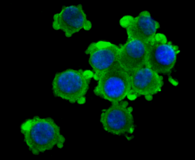 Fig2: ICC staining Kv1.4 in N2A cells (green). The nuclear counter stain is DAPI (blue). Cells were fixed in paraformaldehyde, permeabilised with 0.25% Triton X100/PBS.