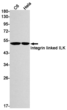 Western blot detection of Integrin linked ILK in C6,Hela cell lysates using Integrin linked ILK Rabbit mAb(1:1000 diluted).Predicted band size:51kDa.Observed band size:51kDa.