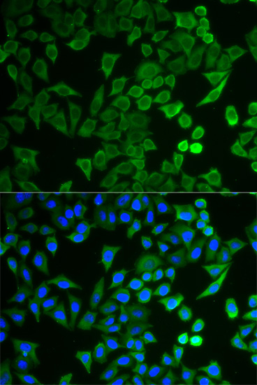 Immunofluorescence - NPRL2 Polyclonal Antibody 