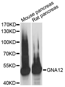 Western blot - GNA12 Polyclonal Antibody 
