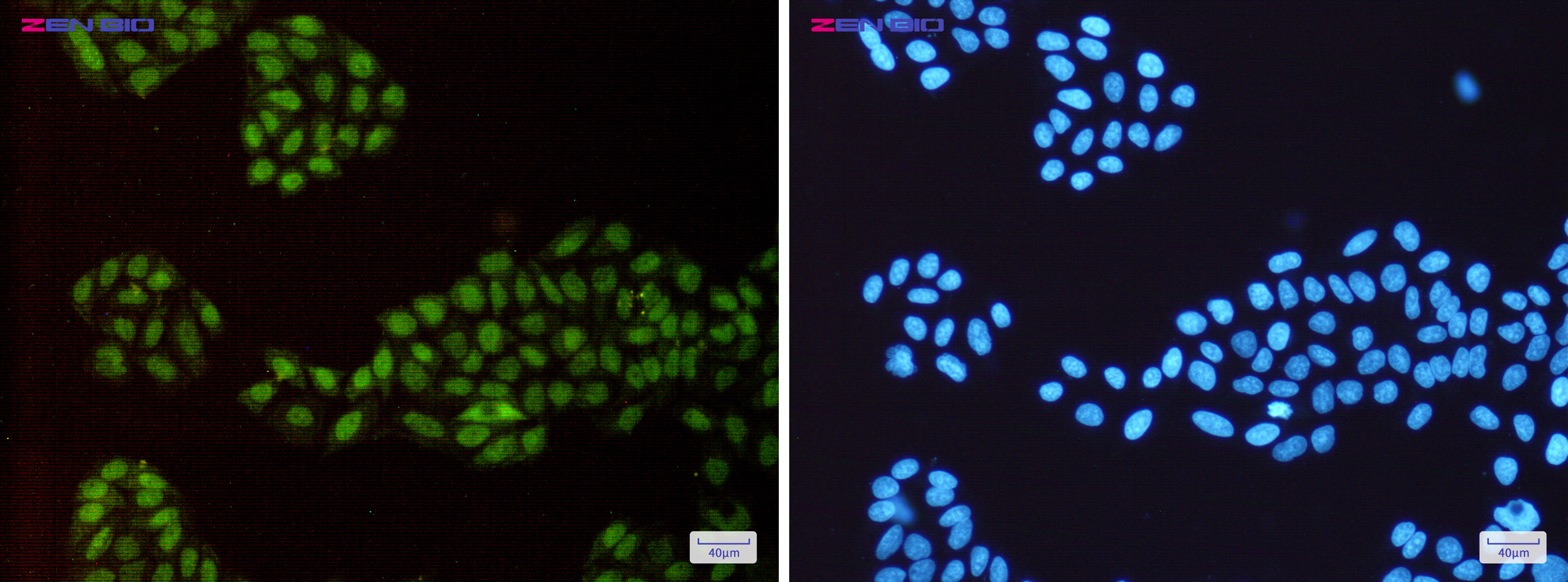 Immunocytochemistry of p150 CAF1(green) in Hela cells using p150 CAF1 Rabbit pAb at dilution 1/50, and DAPI(blue)