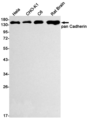 Western blot detection of pan Cadherin in Hela,CHO-K1,C6,Rat Brain lysates using pan Cadherin Rabbit mAb(1:500 diluted).Predicted band size:100kDa.Observed band size:130-150kDa.