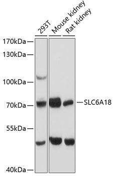 Western blot - SLC6A18 Polyclonal Antibody 