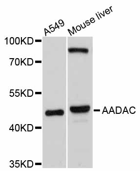 Western blot - AADAC Polyclonal Antibody 