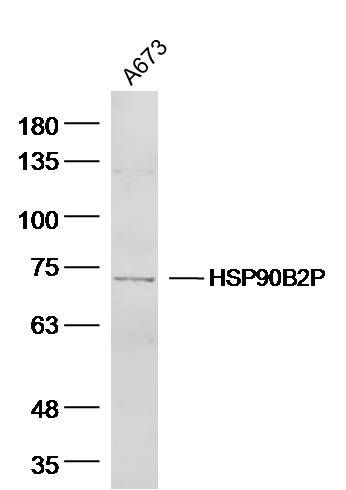 Fig1: Sample: A673 Cell (Human) Lysate at 40 ug; Primary: Anti-HSPA12A at 1/300 dilution; Secondary: IRDye800CW Goat Anti-Rabbit IgG at 1/20000 dilution; Predicted band size: 75 kD; Observed band size: 73 kD