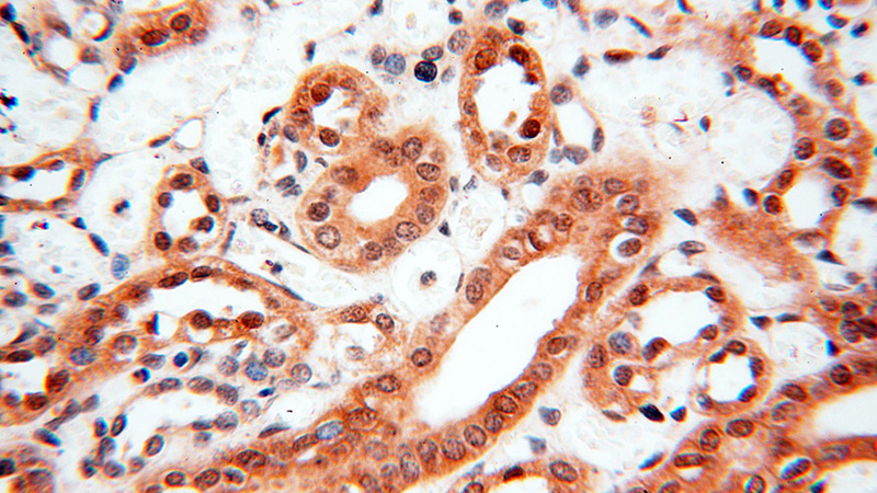 Immunohistochemical of paraffin-embedded human kidney using Catalog No:115393(SMN2 antibody) at dilution of 1:100 (under 40x lens)