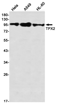 Western blot detection of TPX2 in Hela,A549,HL-60 using TPX2 Rabbit mAb(1:1000 diluted)