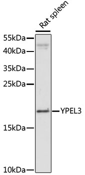 Western blot - YPEL3 Polyclonal Antibody 