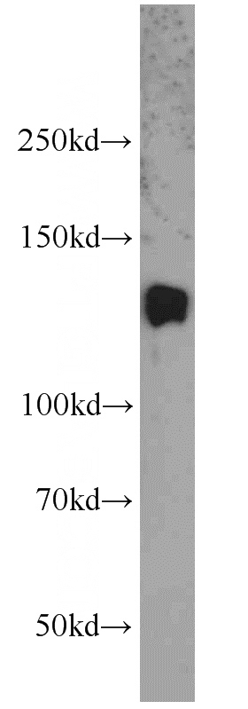 mouse skeletal muscle tissue were subjected to SDS PAGE followed by western blot with Catalog No:116347(Trappc9,NIBP antibody) at dilution of 1:1000