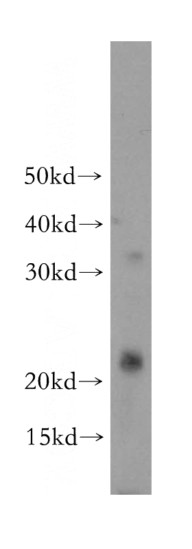 mouse skeletal muscle tissue were subjected to SDS PAGE followed by western blot with Catalog No:114151(PPP1R14B antibody) at dilution of 1:400