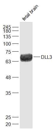 Fig1: Sample:; Fetal brain (Mouse) Lysate at 40 ug; Primary: Anti-DLL3 at 1/1000 dilution; Secondary: IRDye800CW Goat Anti-Rabbit IgG at 1/20000 dilution; Predicted band size: 65 kD; Observed band size: 65 kD
