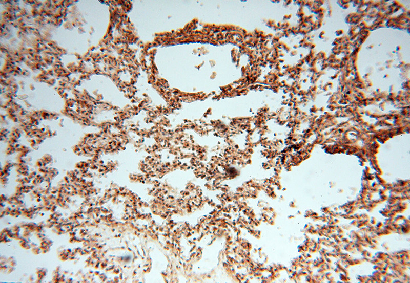 Immunohistochemical of paraffin-embedded human lung using Catalog No:109597(CSK antibody) at dilution of 1:200 (under 10x lens)