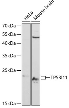 Western blot - TP53I11 Polyclonal Antibody 