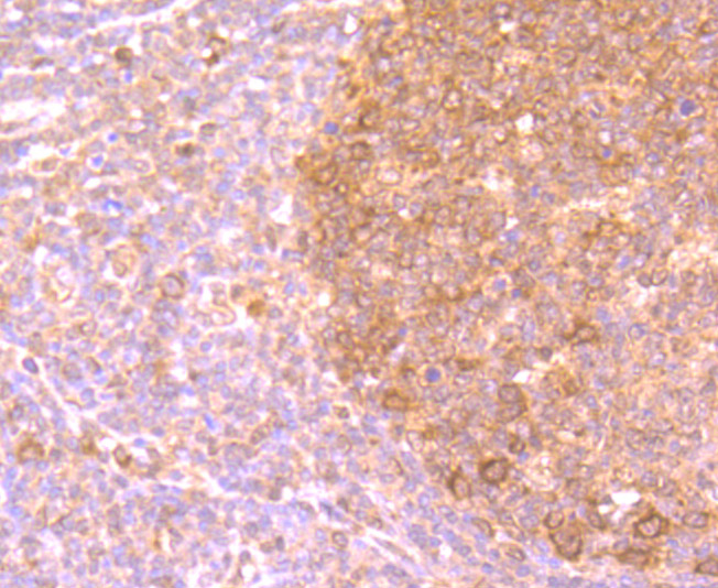 Fig2: Immunohistochemical analysis of paraffin-embedded human tonsil tissue using anti-PFAS antibody. Counter stained with hematoxylin.
