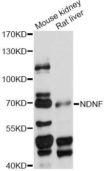 Western blot - NDNF Polyclonal Antibody 
