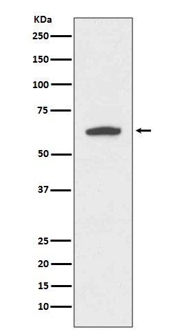 Western blot analysis of Cytokeratin 9 expression in HeLa cell lysate.