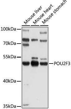 Western blot - POU2F3 Polyclonal Antibody 