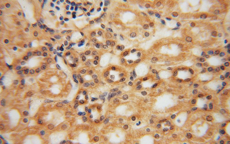 Immunohistochemical of paraffin-embedded human kidney using Catalog No:112956(NARS2 antibody) at dilution of 1:50 (under 40x lens)