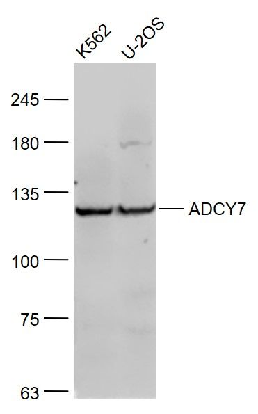 Fig1: Sample:; K562(Human) Cell Lysate at 30 ug; U-2OS(Human) Cell Lysate at 30 ug; Primary: Anti- ADCY7 at 1/1000 dilution; Secondary: IRDye800CW Goat Anti-Rabbit IgG at 1/20000 dilution; Predicted band size: 120 kD; Observed band size: 120 kD