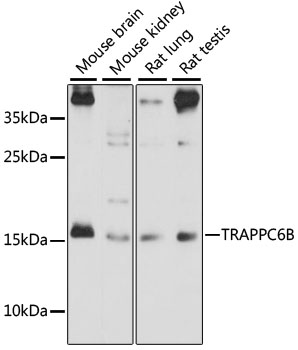 Western blot - TRAPPC6B Polyclonal Antibody 