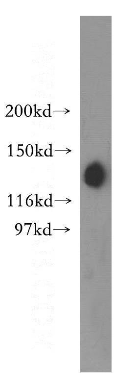 HEK-293 cells were subjected to SDS PAGE followed by western blot with Catalog No:115059(SAP130 antibody) at dilution of 1:400