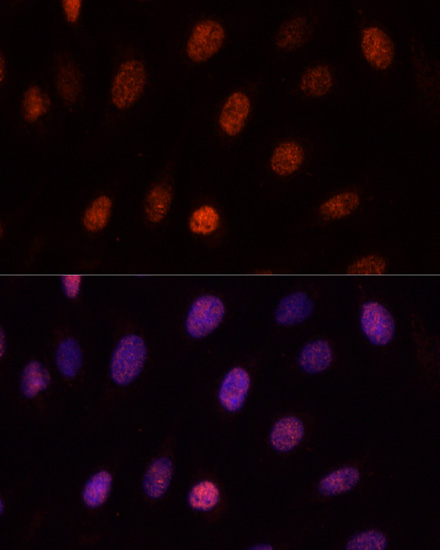 Immunofluorescence - PCGF1 Polyclonal Antibody 
