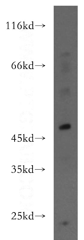 A375 cells were subjected to SDS PAGE followed by western blot with Catalog No:111621(IFIT5 antibody) at dilution of 1:200