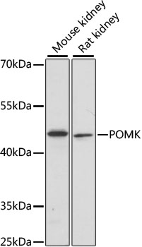 Western blot - POMK Polyclonal Antibody 