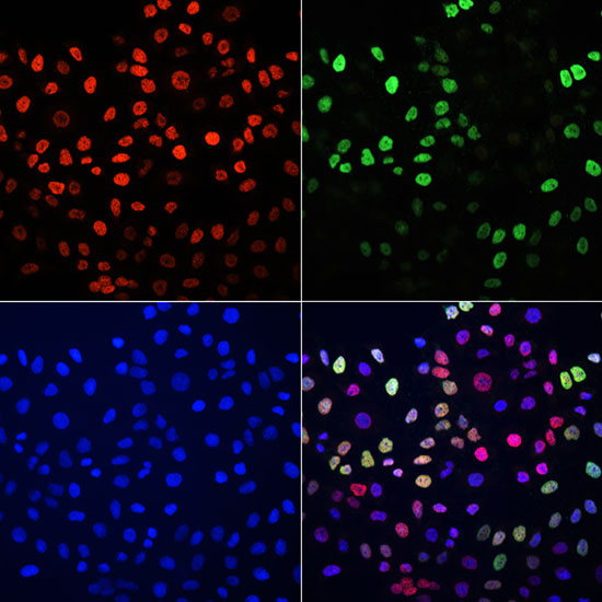 Immunofluorescence - BrdU Monoclonal Antibody 