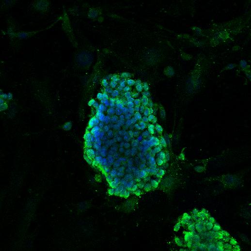 Fig2: ICC staining DPY30 in D3 cells (green). Cells were fixed in paraformaldehyde, permeabilised with 0.25% Triton X100/PBS and counterstained with DAPI in order to highlight the nucleus (blue).