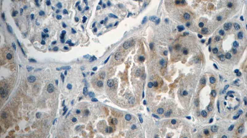 Immunohistochemistry of paraffin-embedded human kidney tissue slide using Catalog No:114897(RPL5 Antibody) at dilution of 1:50 (under 40x lens)