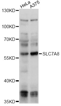 Western blot - SLC7A8 Polyclonal Antibody 