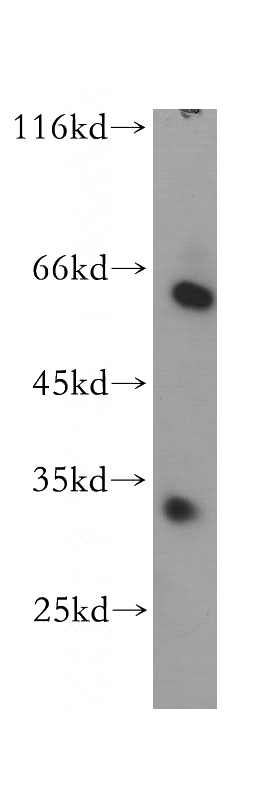 HEK-293 cells were subjected to SDS PAGE followed by western blot with Catalog No:116045(THNSL2 antibody) at dilution of 1:600