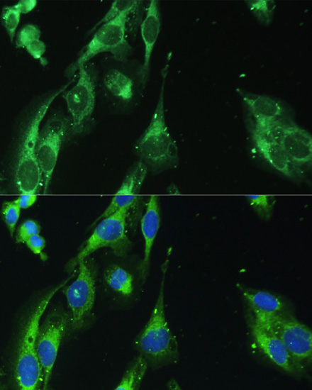 Immunofluorescence - BLOC1S3 Polyclonal Antibody 