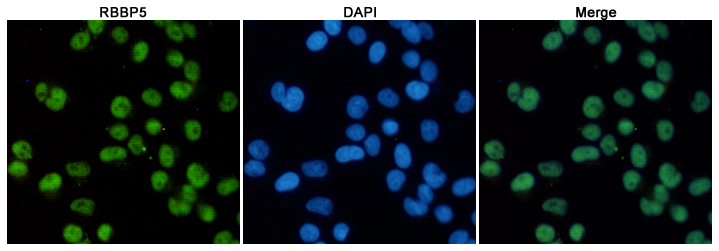 Immunofluorescent analysis of Hela cells fixed with 4% Paraformaldehyde and using anti-RBBP5 mouse mAb (dilution 1:100). DAPI was used to stain nucleus(blue).